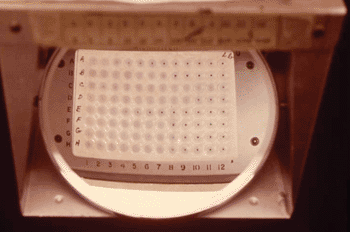 Image: Direct Agglutination Test (Photo courtesy of the Royal Tropical Institute).